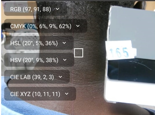 Neck ROI + multi-color-space feature extraction